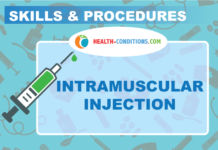 Intramuscular injection